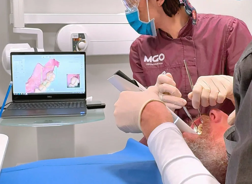 Implantologia 5 Impianto dentale a Busca Cuneo
