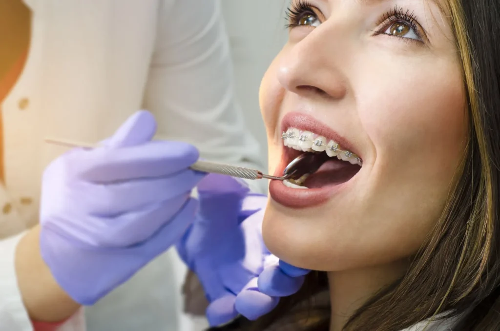Ortodonzia 1 Apparecchio dentale a Busca Cuneo