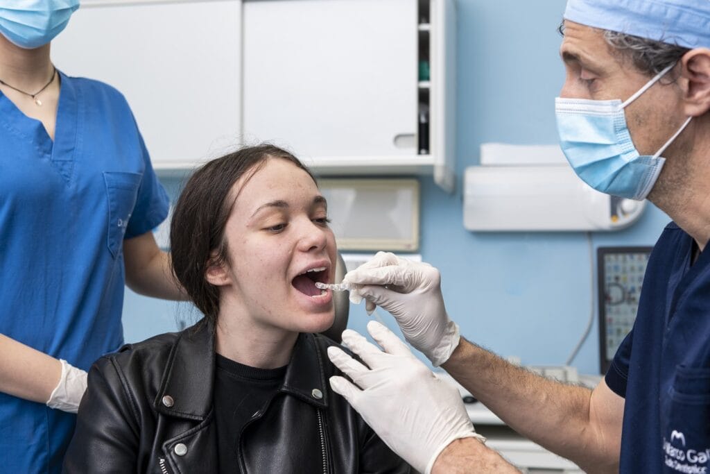 Ortodonzia trasparente: come risolvere il problema di affollamento/allineamento dentale? 2 Allineatori trasparenti