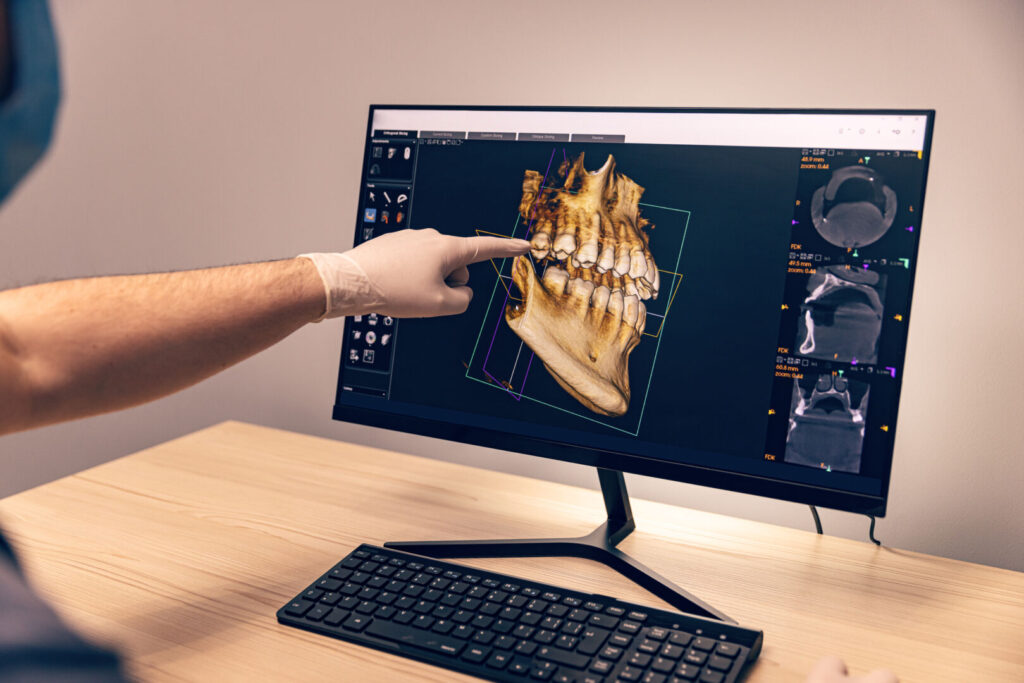 Implantologia Guidata a Busca: La Rivoluzione della Navigazione 3D in Tempo Reale 1 Implantologia Guidata