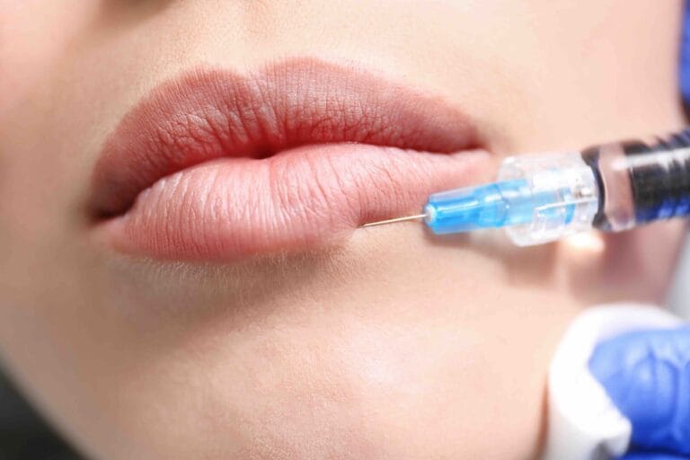 Blog 1 Come mantenere il filler labbra